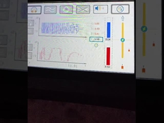 Se trata de un sistema de control de velocidad.
